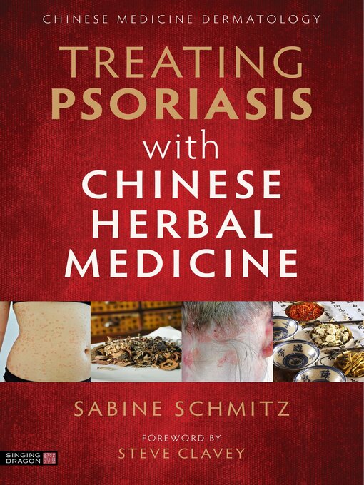 Title details for Treating Psoriasis with Chinese Herbal Medicine (Revised Edition) by Sabine Schmitz - Available